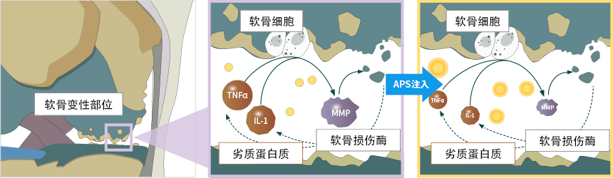 APS疗法 | 日医 | JP APEX